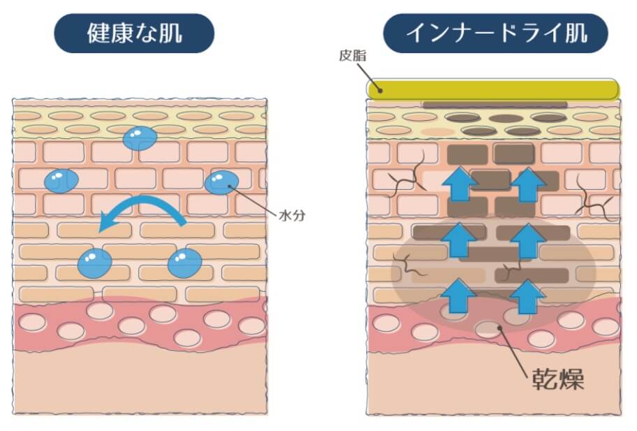 加湿器 東京美肌堂 インナードライ